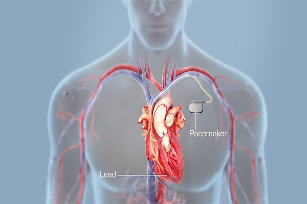 Cardiology